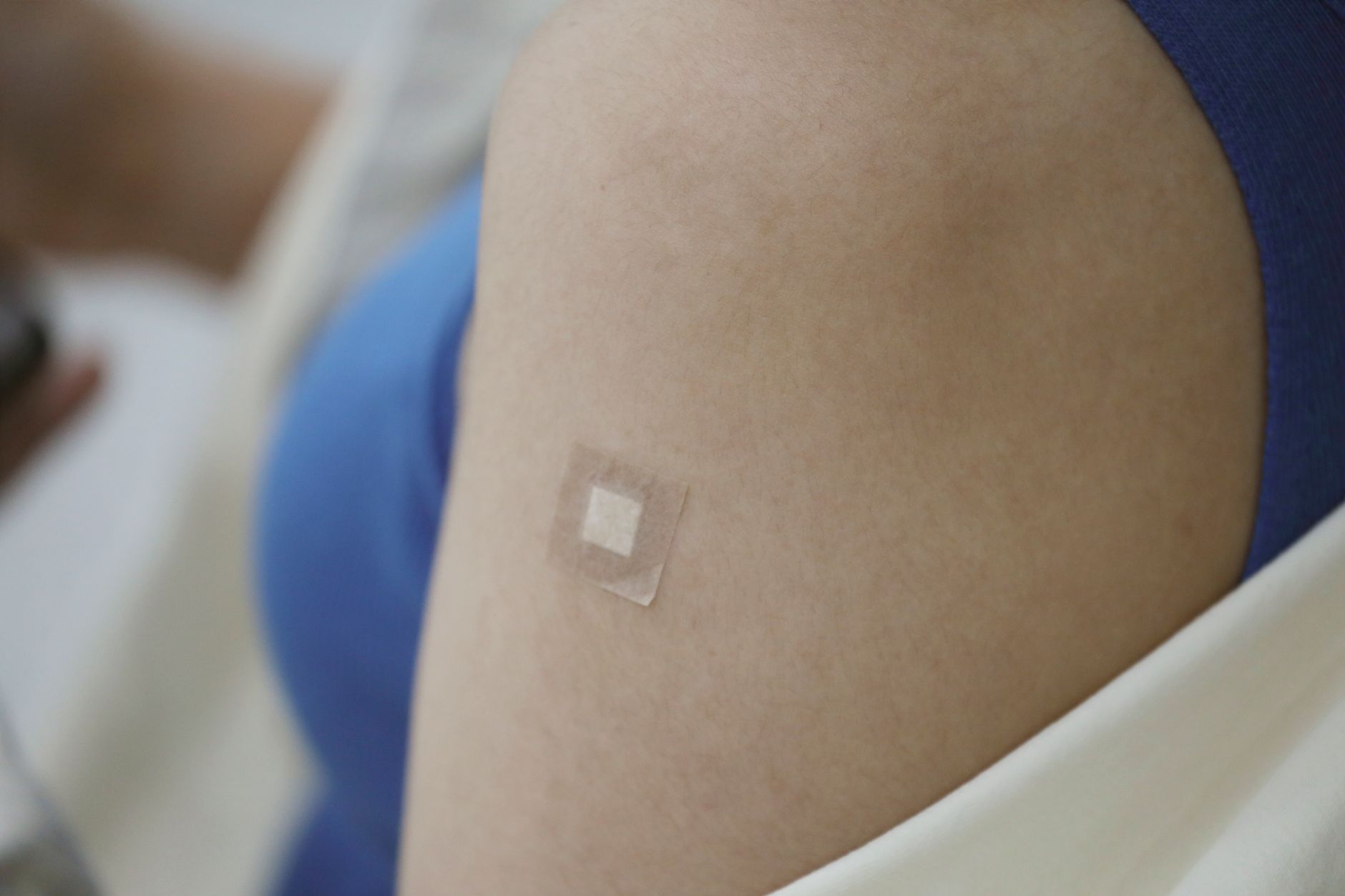 Patch testing strips applied to a patient's back during allergy testing