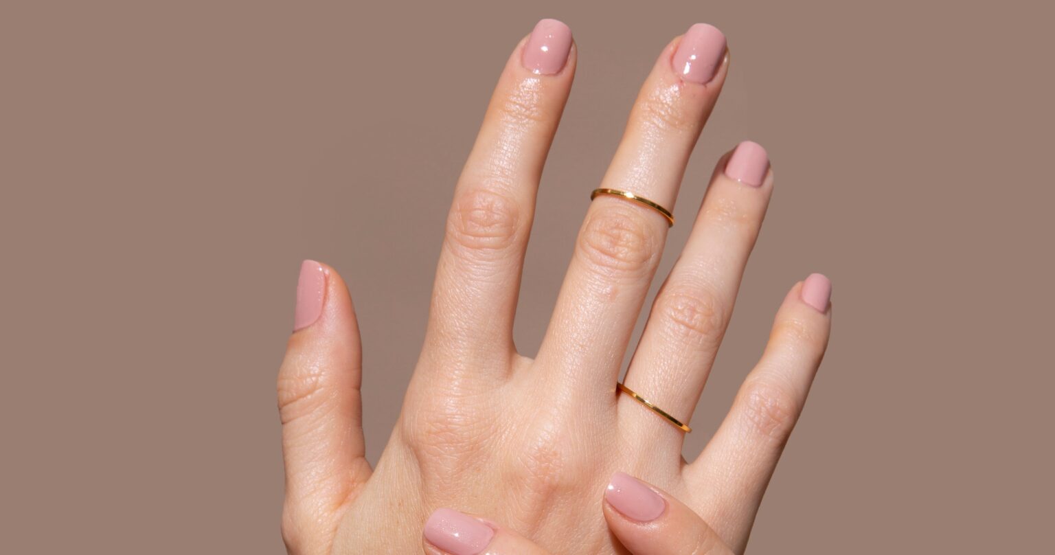 My Honeymoon Rash Led to a Diagnosis My Doctor Refused to Consider Close-up of hands with gel nail extensions showing redness around the nail fold